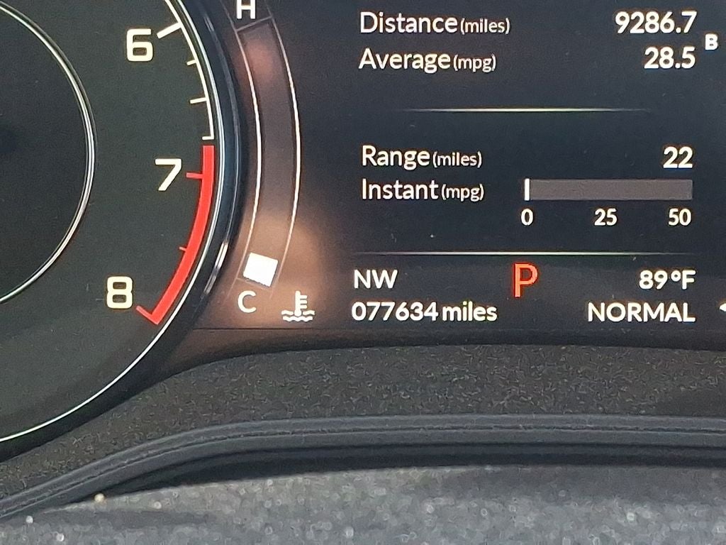 2021 Acura TLX Technology Package